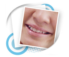 Cosmetic Dentistry Thailand