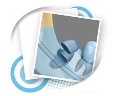 Oral Surgery Dental Service