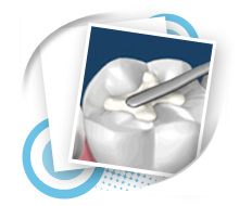 Restorative Dental Service